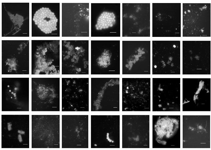 太湖不同湖区有机聚集体的DAPI 荧光染色图